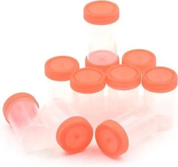 500 URINE POTJES plaspotjes Urinewegtesten 100 stuks 120 ml - Urine - Medisch - Testen van virus - bacteriën - Infecties - Zwangerschap - Pillendoos - Urine - Bakjes - Steriel - Fles - Urine container