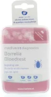 Borrelia - Bloedtest