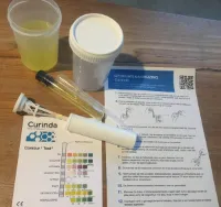 Curinda, een urine zelftest kit. U krijgt 2 urine opvangbeker met  2 combur 7 test strip zodat U zelf Uw urine 2 keer kunt testen op parameters zoals o.a. suiker, eiwit, witte bloed lichaampjes.